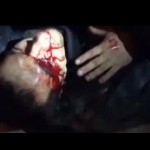  Евротвари выкололи глаз и отрубили руку пленному бойцу «Беркута»